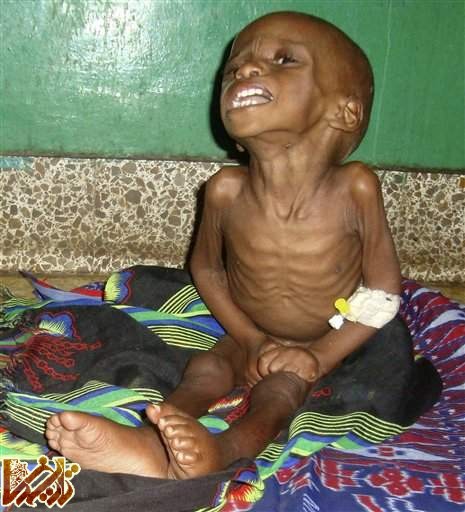 http://enikazemi.ir/images/2011/08/Somalia-People-Suffer-Hunger131.jpg