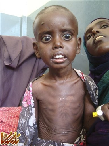 http://enikazemi.ir/images/2011/08/somalia-child-starving-080211jpg-359fc353bbcc862b131.jpg