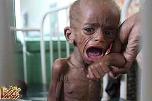 https://enikazemi.ir/images/2011/08/famine-somalia600101.jpg