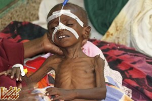 https://enikazemi.ir/images/2011/08/somalia-child-60061.jpg